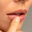 The Wing Horn Chestnut Shaped Corner Lip Lift Enhance Your Smile